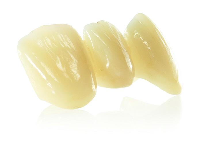 Rekonstrukcija z uporabo materiala Zenostar MT